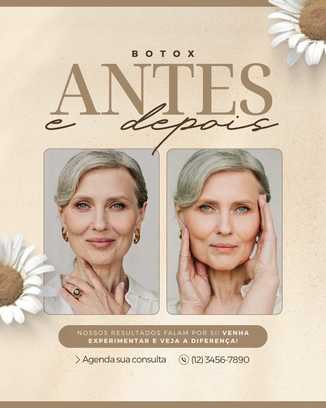 Antes